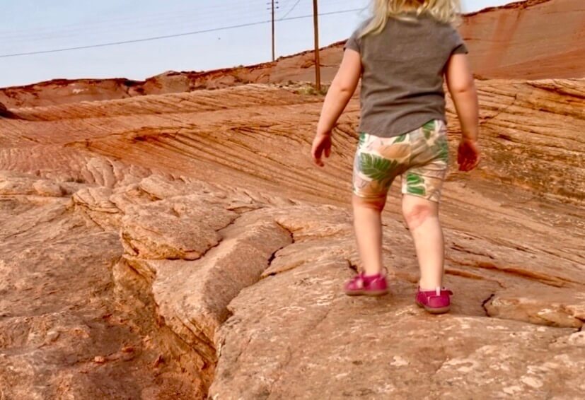 Claire before her Tiny Health gut test, eczema visible on the back of her knee